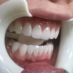 В КИТАЙ НА ПРОТЕЗИРОВАНИЕ,ИЩУ ПОПУТЧИКОВ